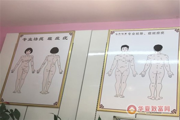 朱氏祖传中药点痣加盟